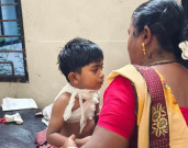 इटियाडोह धरणावर दुर्दैवी घटना:बिबट्याच्या हल्ल्यात ४ वर्षीय बालक गंभीर जखमी